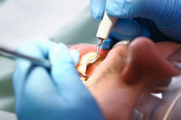 Best Pediatric Emergency Dentist in Center Hill, FL
