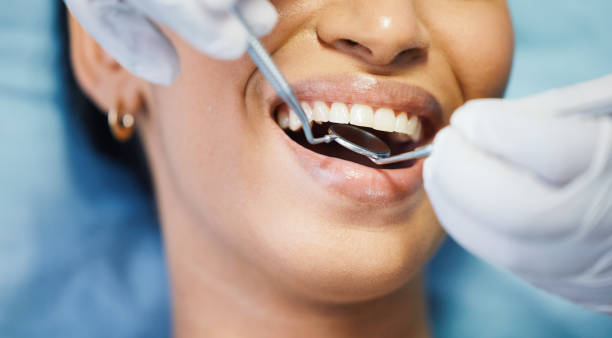 Best Emergency Tooth Extraction in Center Hill, FL