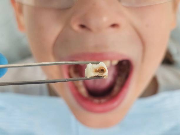 Best Emergency Orthodontic Repairs in Center Hill, FL